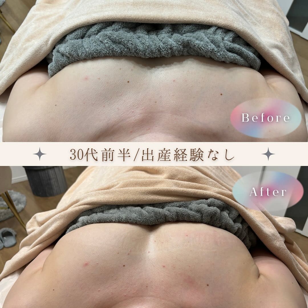Before and After 2